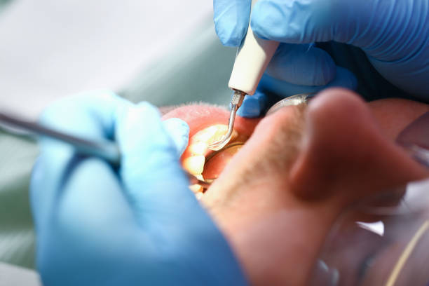 Best Emergency TMJ Treatment in Ranson, WV